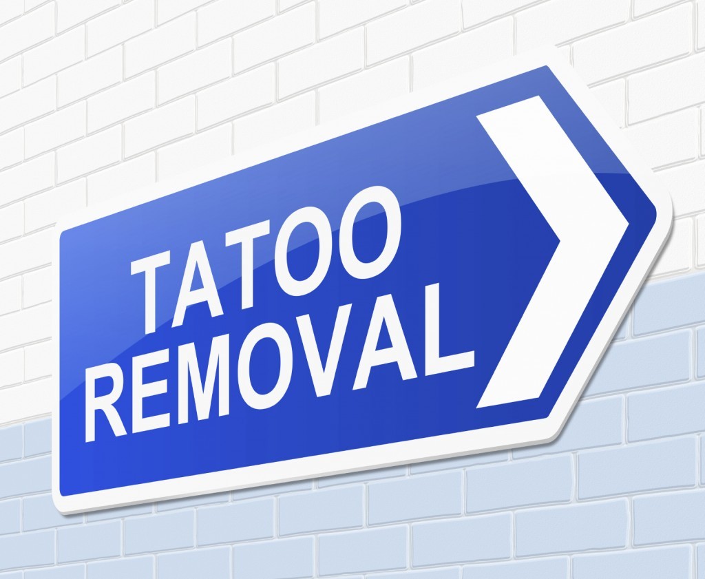 Tattoo-Removal-Sign-iStock_000057521534_Medium-1024x841