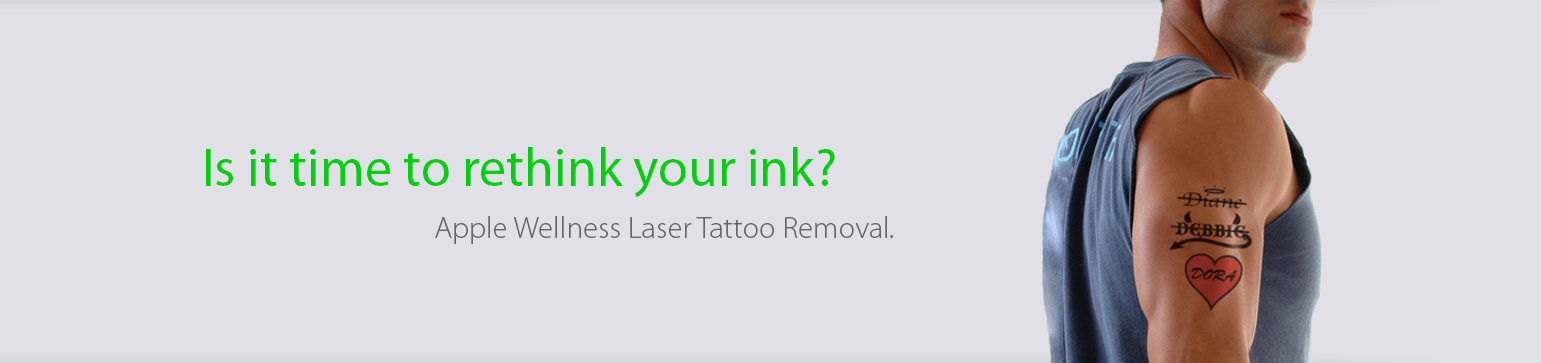 Apple Wellness Laser Tattoo Removal